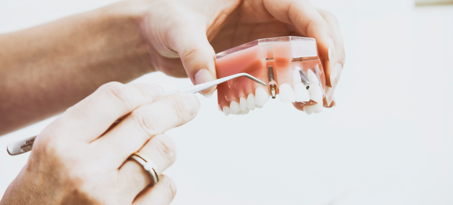 Протезирование зубов