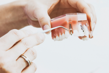 Протезирование зубов